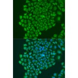 Immunofluorescence - Anti-YB1 Antibody (A91535) - Antibodies.com