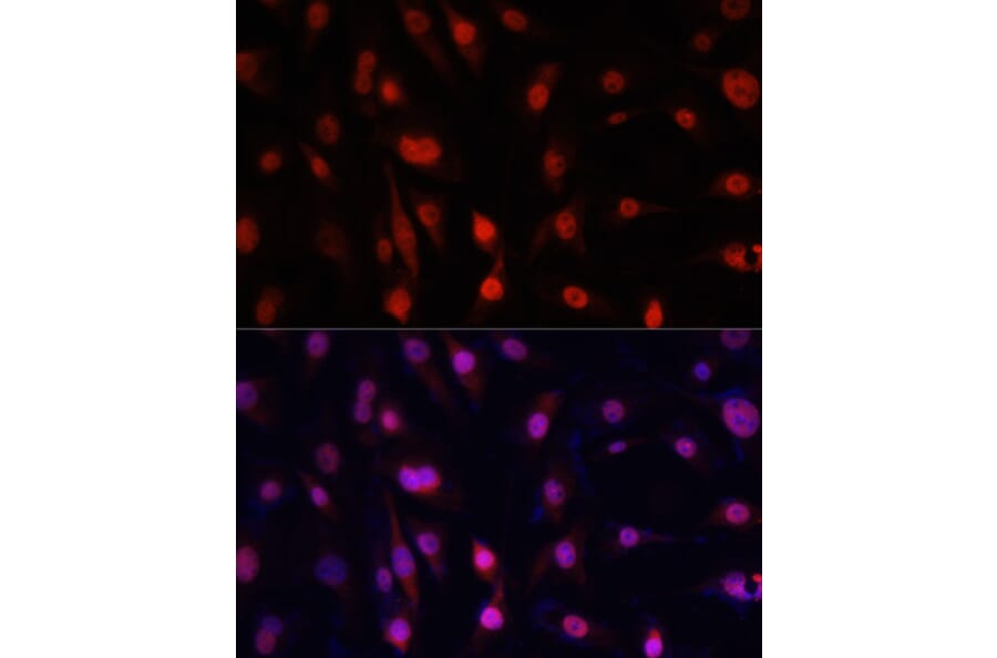 Immunofluorescence - Anti-YB1 Antibody (A91535) - Antibodies.com