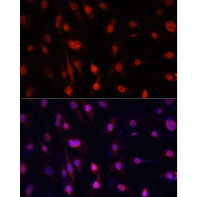 Immunofluorescence - Anti-YB1 Antibody (A91535) - Antibodies.com