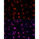 Immunofluorescence - Anti-YB1 Antibody (A91535) - Antibodies.com