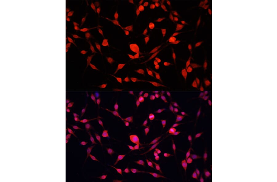 Immunofluorescence - Anti-YB1 Antibody (A91535) - Antibodies.com