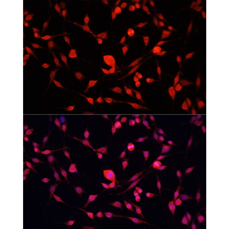 Immunofluorescence - Anti-YB1 Antibody (A91535) - Antibodies.com