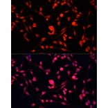 Immunofluorescence - Anti-YB1 Antibody (A91535) - Antibodies.com