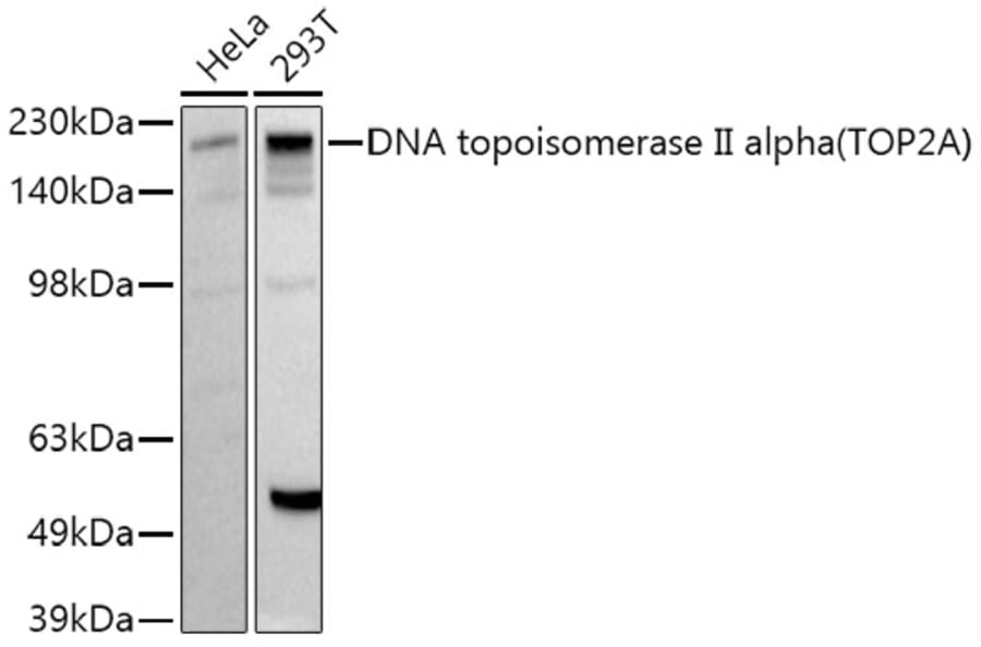 Western Blot - Anti-Topoisomerase II alpha Antibody (A91536) - Antibodies.com