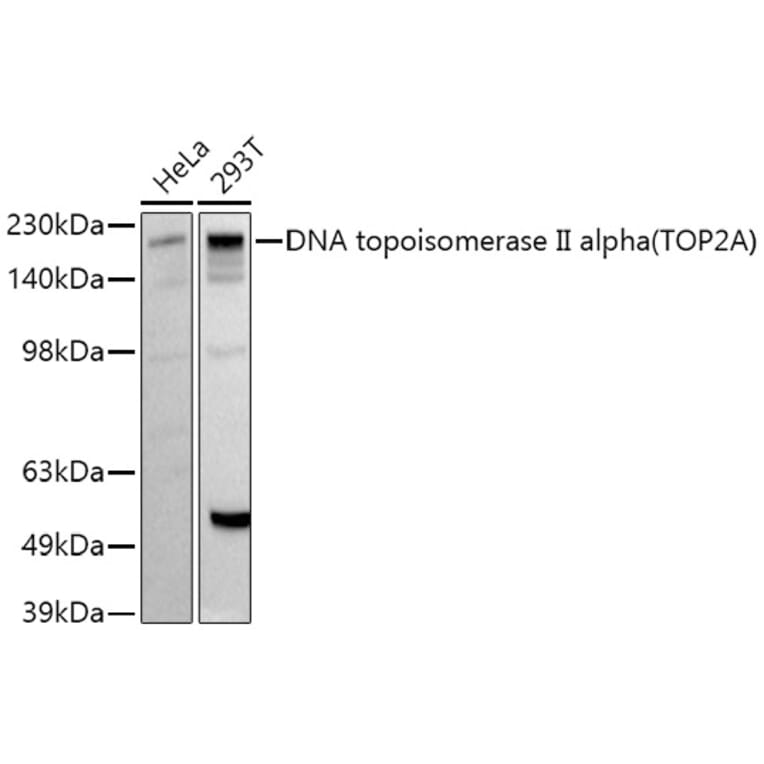 Western Blot - Anti-Topoisomerase II alpha Antibody (A91536) - Antibodies.com