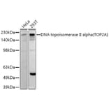 Western Blot - Anti-Topoisomerase II alpha Antibody (A91536) - Antibodies.com