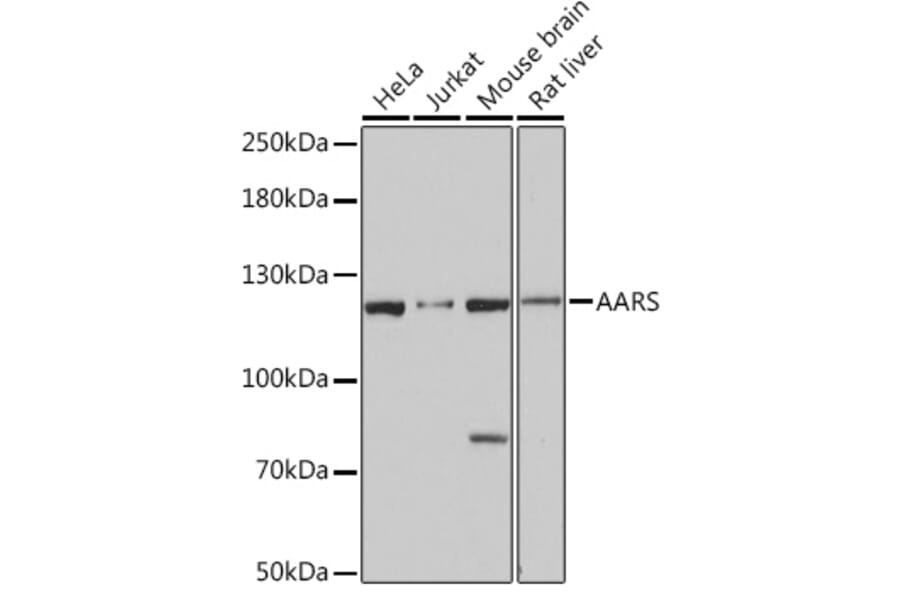 Western Blot - Anti-AlaRS Antibody (A91537) - Antibodies.com