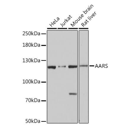 Western Blot - Anti-AlaRS Antibody (A91537) - Antibodies.com