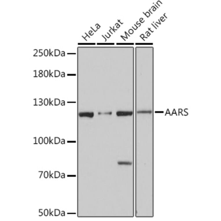 Western Blot - Anti-AlaRS Antibody (A91537) - Antibodies.com