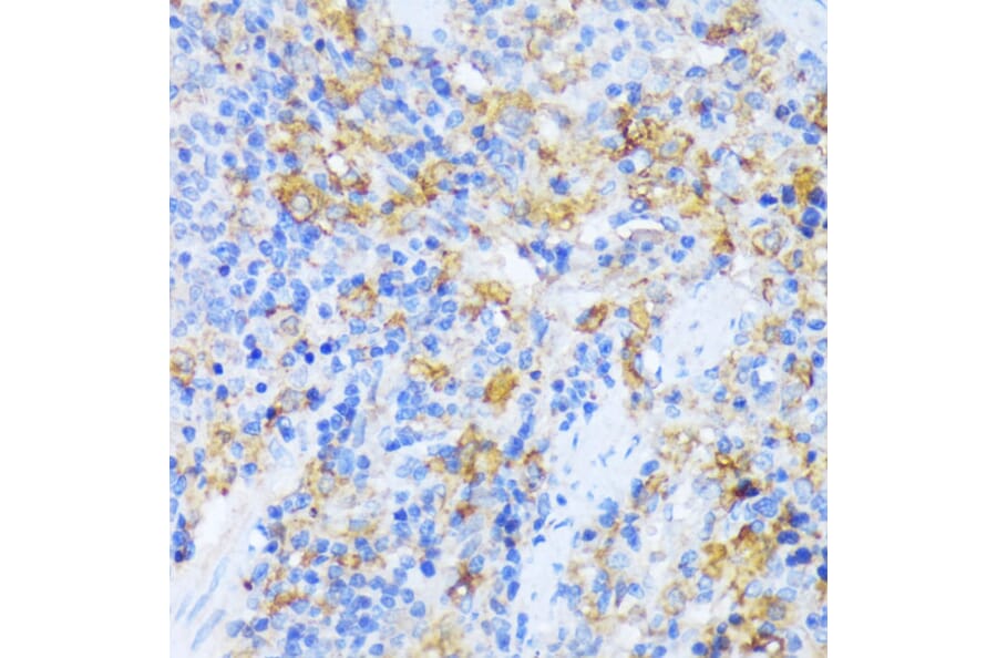 Immunohistochemistry - Anti-AlaRS Antibody (A91537) - Antibodies.com
