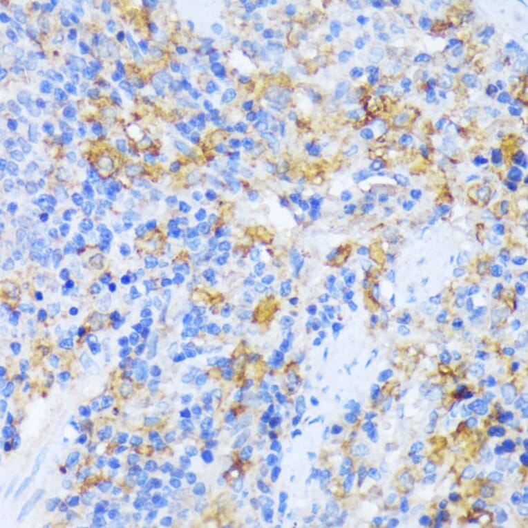 Immunohistochemistry - Anti-AlaRS Antibody (A91537) - Antibodies.com
