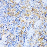 Immunohistochemistry - Anti-AlaRS Antibody (A91537) - Antibodies.com