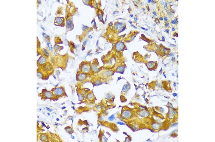 Immunohistochemistry - Anti-AlaRS Antibody (A91537) - Antibodies.com