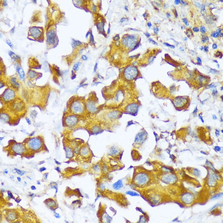 Immunohistochemistry - Anti-AlaRS Antibody (A91537) - Antibodies.com