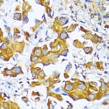 Immunohistochemistry - Anti-AlaRS Antibody (A91537) - Antibodies.com