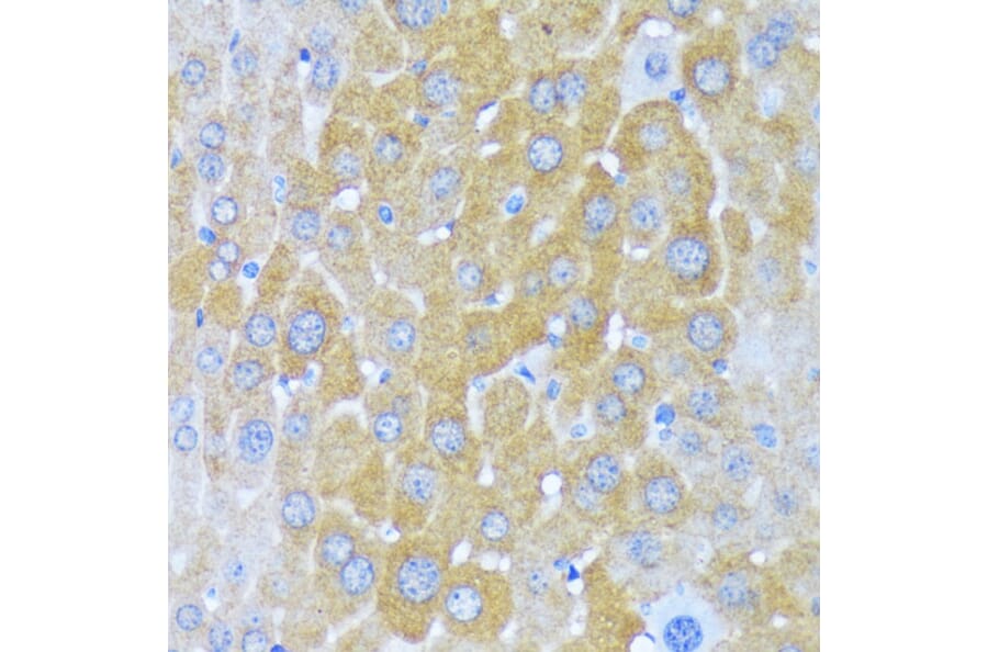 Immunohistochemistry - Anti-AlaRS Antibody (A91537) - Antibodies.com