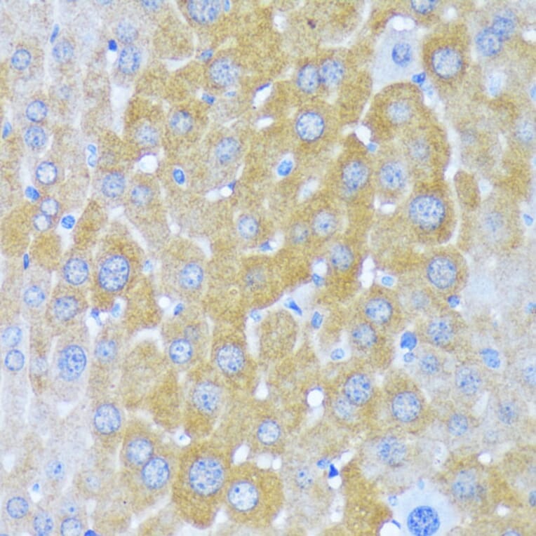 Immunohistochemistry - Anti-AlaRS Antibody (A91537) - Antibodies.com