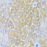 Immunohistochemistry - Anti-AlaRS Antibody (A91537) - Antibodies.com
