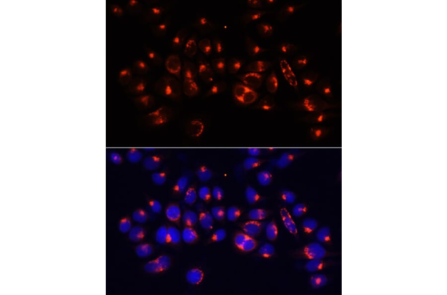 Immunofluorescence - Anti-AlaRS Antibody (A91537) - Antibodies.com