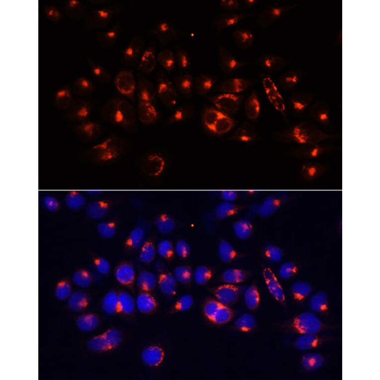 Immunofluorescence - Anti-AlaRS Antibody (A91537) - Antibodies.com