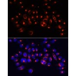 Immunofluorescence - Anti-AlaRS Antibody (A91537) - Antibodies.com