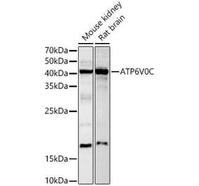 Western Blot - Anti-ATP6V0C Antibody (A91538) - Antibodies.com