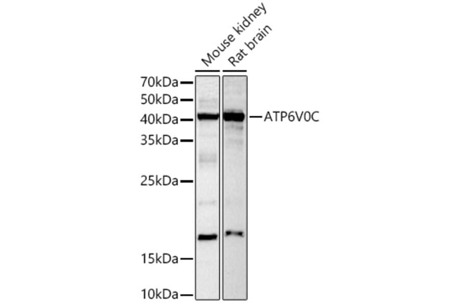 Western Blot - Anti-ATP6V0C Antibody (A91538) - Antibodies.com