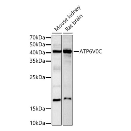 Western Blot - Anti-ATP6V0C Antibody (A91538) - Antibodies.com