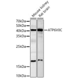 Western Blot - Anti-ATP6V0C Antibody (A91538) - Antibodies.com