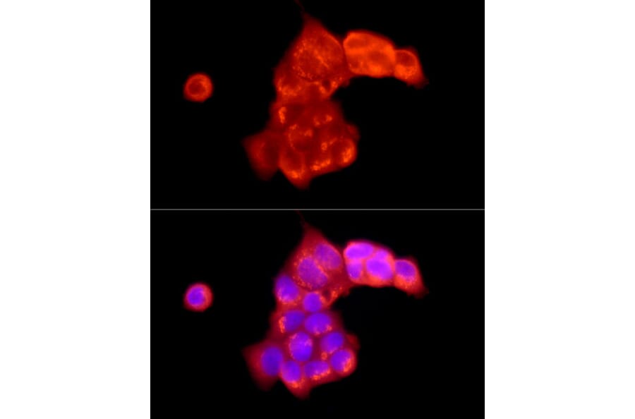 Immunofluorescence - Anti-ATP6V0C Antibody (A91538) - Antibodies.com