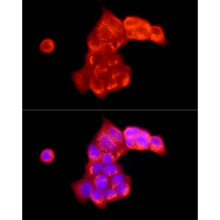 Immunofluorescence - Anti-ATP6V0C Antibody (A91538) - Antibodies.com