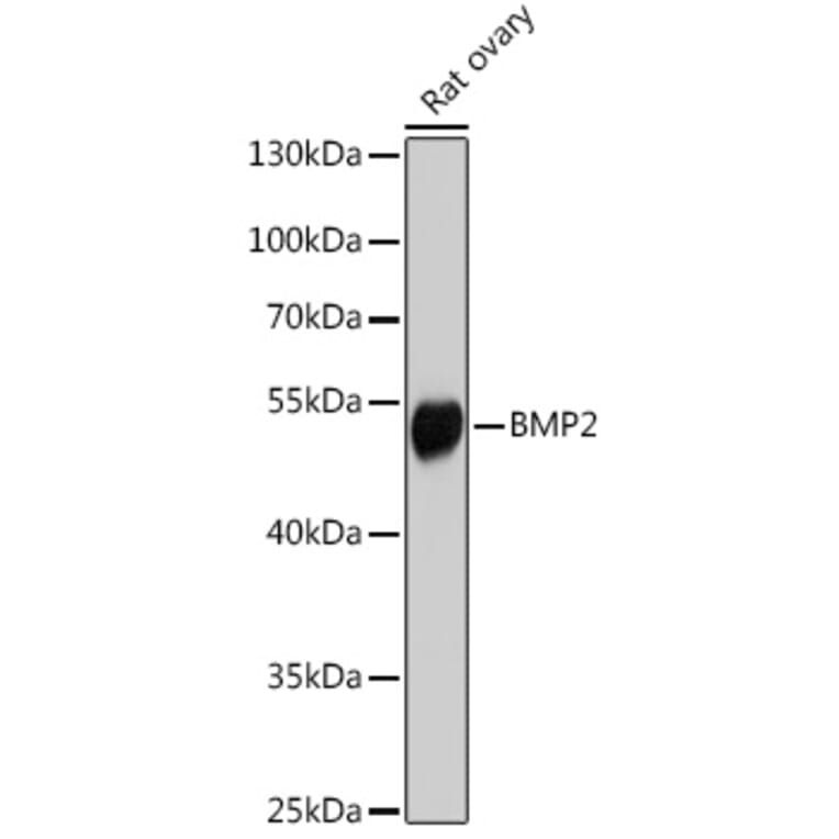 Western Blot - Anti-BMP2 Antibody (A91539) - Antibodies.com