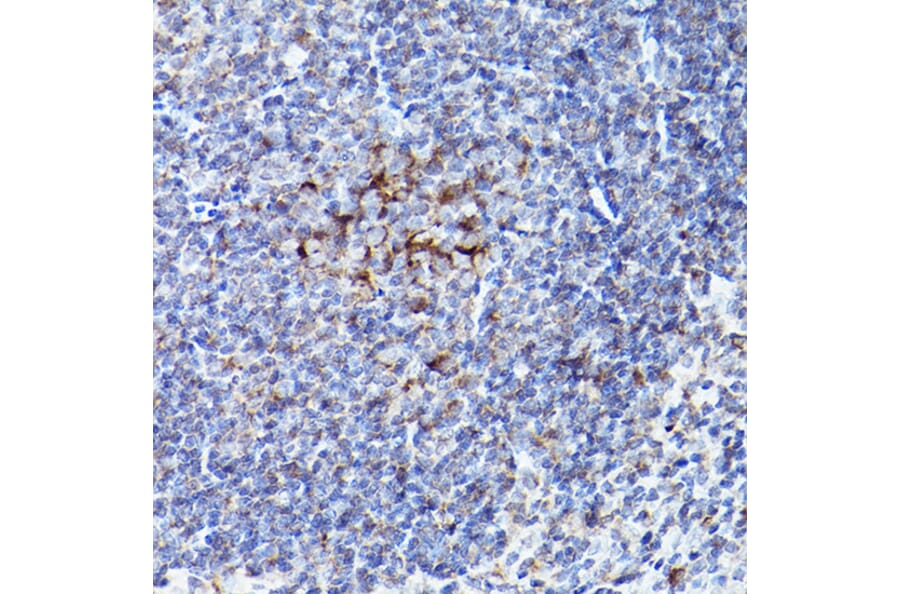 Immunohistochemistry - Anti-Bok Antibody (A91540) - Antibodies.com