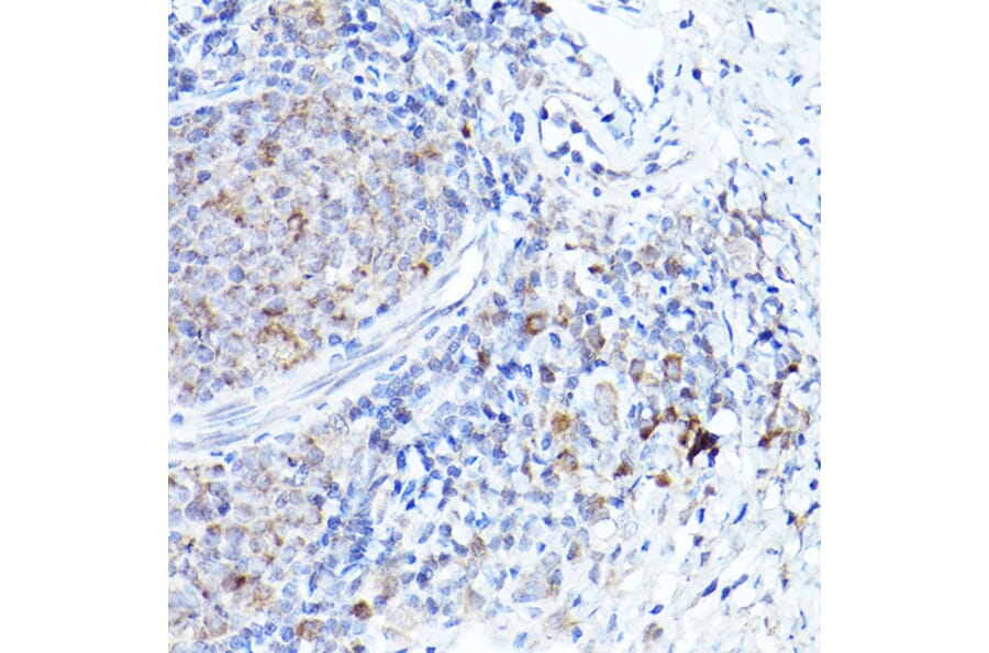 Immunohistochemistry - Anti-Bok Antibody (A91540) - Antibodies.com