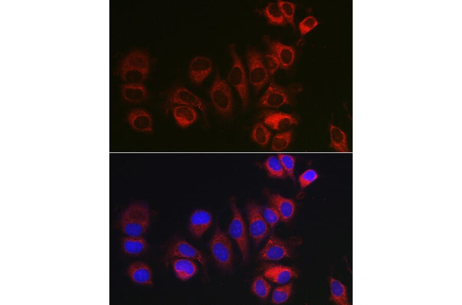 Immunofluorescence - Anti-Bok Antibody (A91540) - Antibodies.com