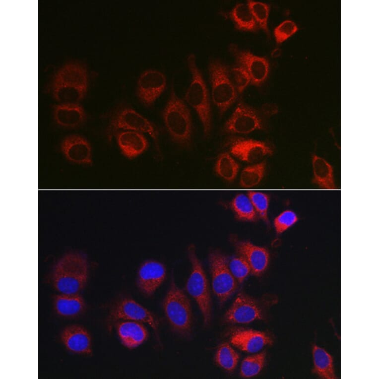 Immunofluorescence - Anti-Bok Antibody (A91540) - Antibodies.com