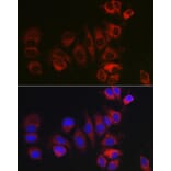 Immunofluorescence - Anti-Bok Antibody (A91540) - Antibodies.com