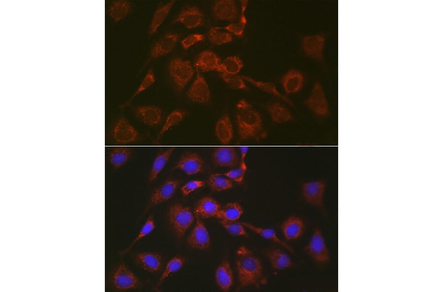 Immunofluorescence - Anti-Bok Antibody (A91540) - Antibodies.com