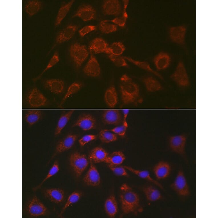 Immunofluorescence - Anti-Bok Antibody (A91540) - Antibodies.com
