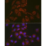 Immunofluorescence - Anti-Bok Antibody (A91540) - Antibodies.com
