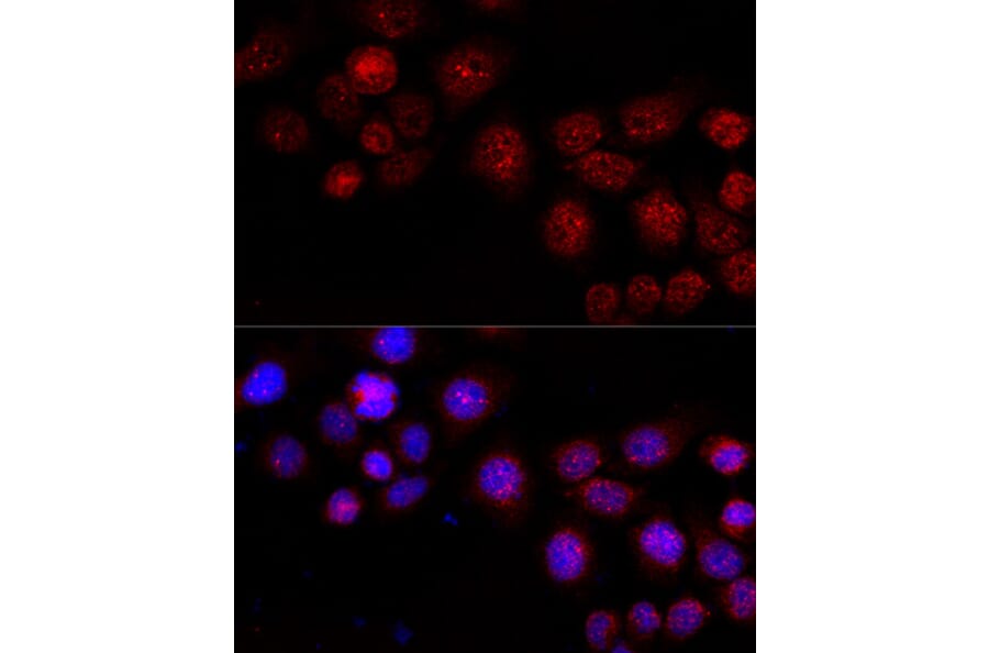 Immunofluorescence - Anti-CXCR4 Antibody (A15112) - Antibodies.com