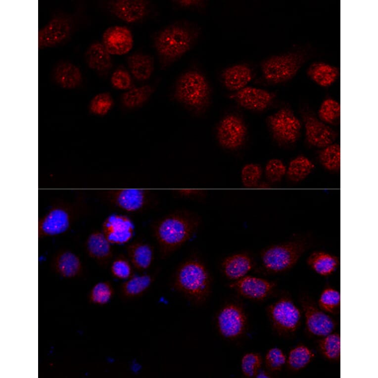Immunofluorescence - Anti-CXCR4 Antibody (A15112) - Antibodies.com