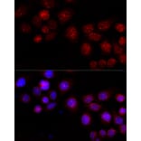 Immunofluorescence - Anti-CXCR4 Antibody (A15112) - Antibodies.com