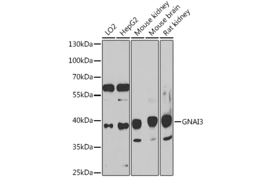 Western Blot - Anti-GNAI3 Antibody (A91543) - Antibodies.com