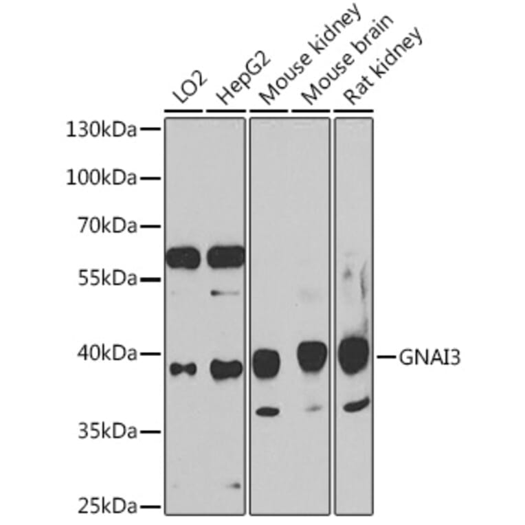 Western Blot - Anti-GNAI3 Antibody (A91543) - Antibodies.com