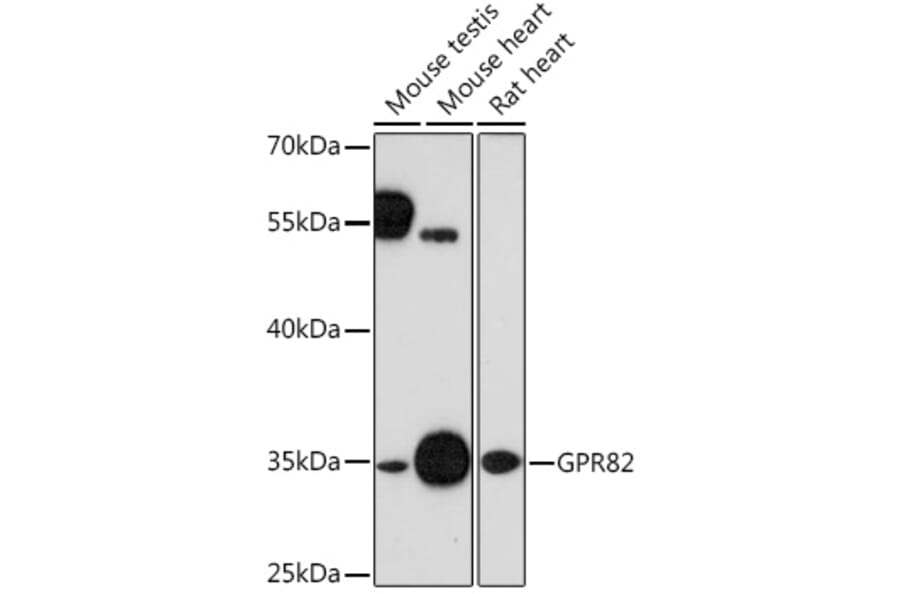 Western Blot - Anti-GPR82 Antibody (A91544) - Antibodies.com