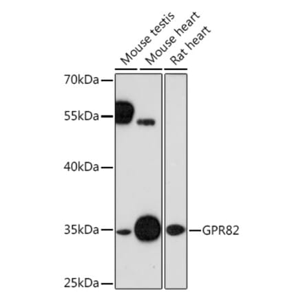 Western Blot - Anti-GPR82 Antibody (A91544) - Antibodies.com