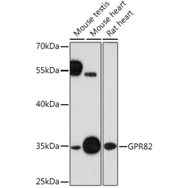 Western Blot - Anti-GPR82 Antibody (A91544) - Antibodies.com