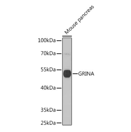 Western Blot - Anti-GRINA Antibody (A91545) - Antibodies.com