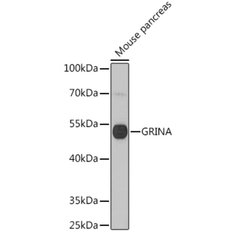 Western Blot - Anti-GRINA Antibody (A91545) - Antibodies.com